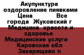 Акупунктура, оздоровление пиявками › Цена ­ 3 000 - Все города, Жуковский г. Медицина, красота и здоровье » Медицинские услуги   . Кировская обл.,Захарищево п.